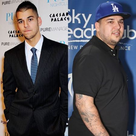Rob Kardashian's before and after pictures/
